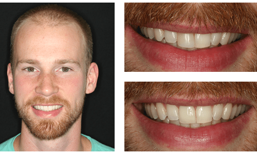 after dentistry at Dental Distinction: Jason Petkevis, DMD