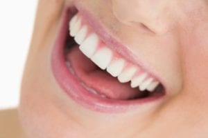 How Can Crooked Teeth Be Fixed?