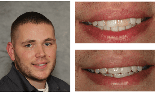 after dentistry at Dental Distinction: Jason Petkevis, DMD