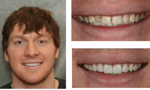 after dentistry at Dental Distinction: Jason Petkevis, DMD