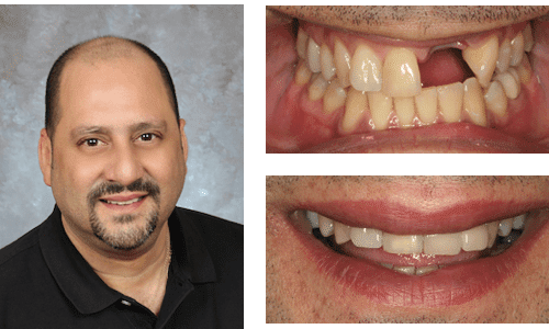 after dentistry at Dental Distinction: Jason Petkevis, DMD