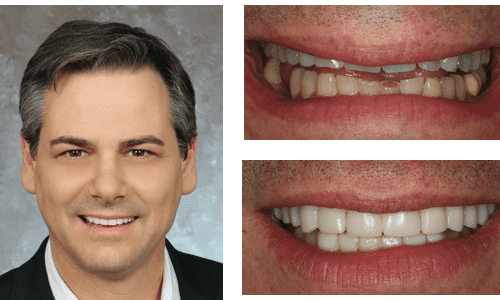 after dentistry at Dental Distinction: Jason Petkevis, DMD