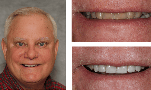 after dentistry at Dental Distinction: Jason Petkevis, DMD