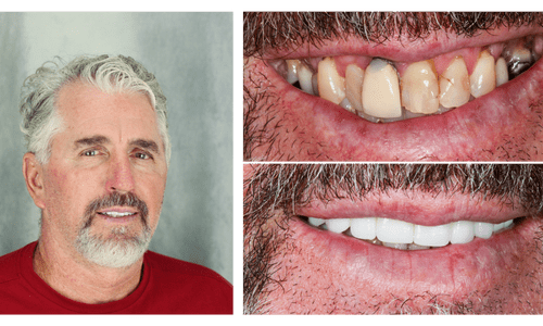 after dentistry at Dental Distinction: Jason Petkevis, DMD