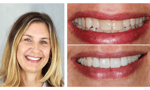 after dentistry at Dental Distinction: Jason Petkevis, DMD