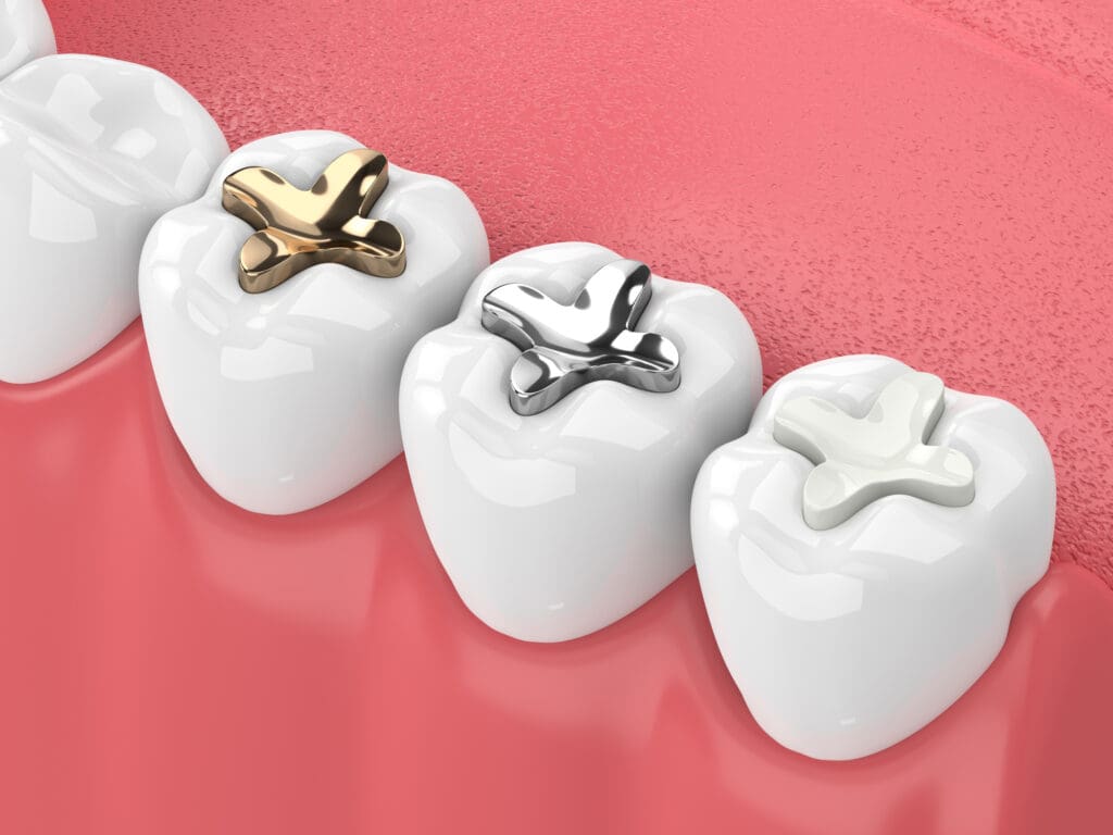 Dental Fillings in Chester Springs PA