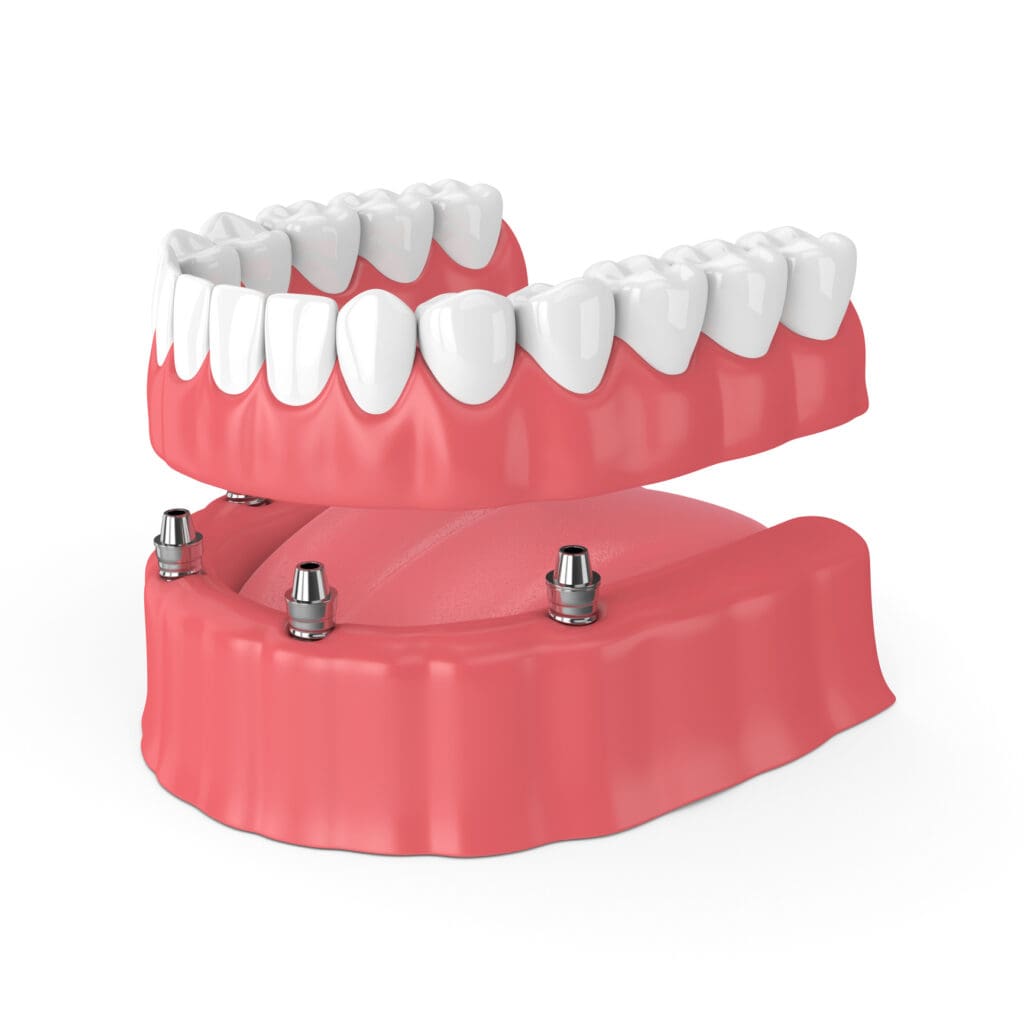 Dentures and Partials in Chester Springs PA