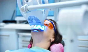 Why Invest in Professional Teeth Whitening in Chester Springs, PA